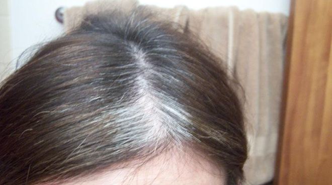 The roles of Vitamin E for caring hair