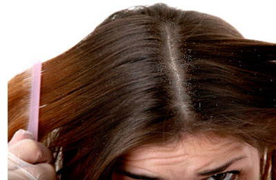itchy scalp and hair loss 1